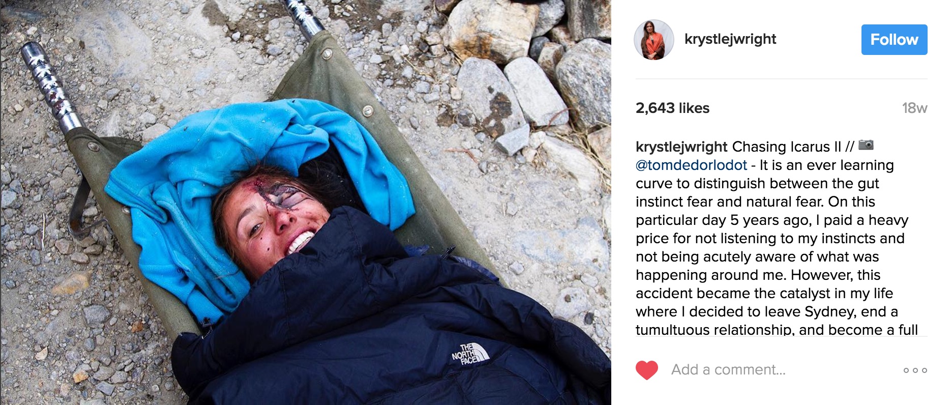 Krystle Wright injury photo Instagram